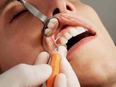 How Students Use AI to Prepare for Oral Examinations